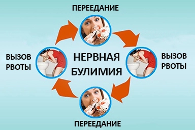 Лечение булимии в Почепе